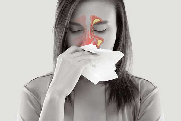 Woman with a sinus infection.